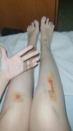 Una vecina sufre una caída en Blanca de los Ríos por el mal estado del suelo