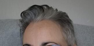 Bárbara vuelve a sonreír tras la operación que le cambiará la vida