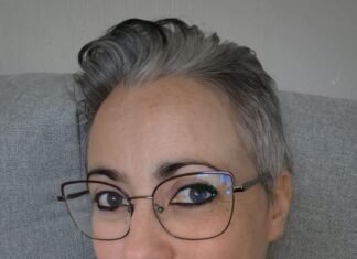 Bárbara vuelve a sonreír tras la operación que le cambiará la vida